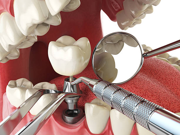 Best Emergency Tooth Extraction  in Lamoni, IA